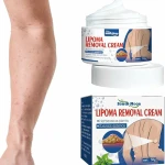 Herbal Lipoma Removal Cream – Targeted Non-Invasive Fatty Nodule Care