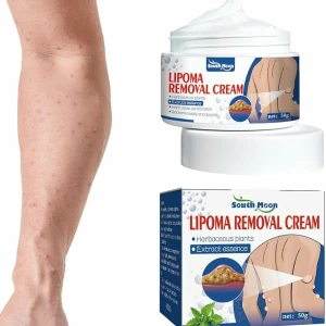 Herbal Lipoma Removal Cream – Targeted Non-Invasive Fatty Nodule Care